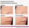 Strivectin Advanced Retinol Concentrated Serum Silnie działające serum z retinolem 30 ml,.jpg