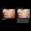 vitamin-b3-brightening-serum.jpg