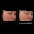 retinol-treatment-for-sensitive-skin.jpg