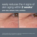 dynamic-skin-retinol-serum_clinical-b_a_1.webp