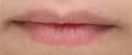 LipDuo_B_A_FrontLip_Baseline-01.webp